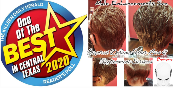 Man Weave / Male Hair Replacement